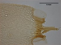 Acanthorrhynchium papillatum (Harv.) Fleisch. Collection Image, Figure 11, Total 11 Figures